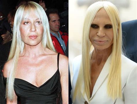 donatella versace d|donatella versace before and after.